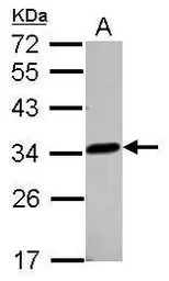 Anti-LACTB2 antibody used in Western Blot (WB). GTX122755