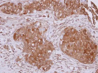 Anti-STUB1 antibody [N1C3] used in IHC (Paraffin sections) (IHC-P). GTX122827