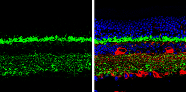 Anti-Complexin 3 antibody used in IHC (Paraffin sections) (IHC-P). GTX122908