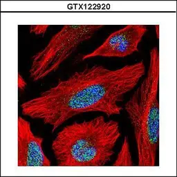 Anti-BAF53B antibody used in Immunocytochemistry/ Immunofluorescence (ICC/IF). GTX122920