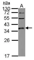 Anti-ULBP1 antibody [N1C3] used in Western Blot (WB). GTX123021