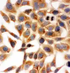 Anti-HSD17B1 antibody used in Immunocytochemistry/ Immunofluorescence (ICC/IF). GTX12312