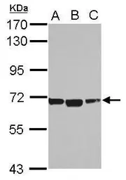 Anti-ACSM1 antibody used in Western Blot (WB). GTX123303