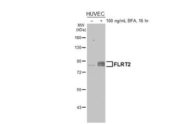 Anti-FLRT2 antibody used in Western Blot (WB). GTX123309