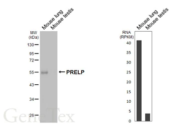 Anti-PRELP antibody used in Western Blot (WB). GTX123359