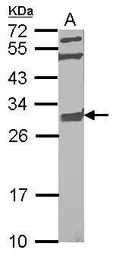 Anti-GBAS antibody used in Western Blot (WB). GTX123416