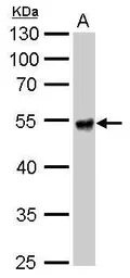 Anti-ALDH1A1 antibody used in Western Blot (WB). GTX123426