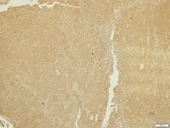 Anti-ADAMTS5 antibody [N3C2], Internal used in IHC (Paraffin sections) (IHC-P). GTX123657