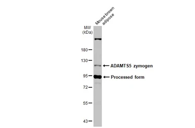 Anti-ADAMTS5 antibody [N3C2], Internal used in Western Blot (WB). GTX123657