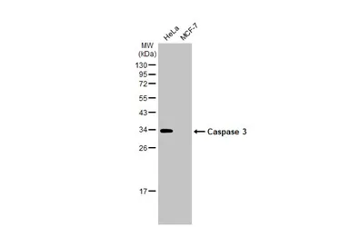 Anti-Caspase 3 antibody used in Western Blot (WB). GTX123678