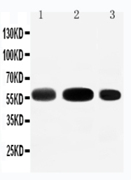 Anti-EAAT3 antibody used in Western Blot (WB). GTX12393