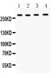 Anti-IGF2R antibody used in Western Blot (WB). GTX12397