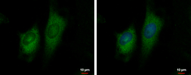 Anti-GFM2 antibody used in Immunocytochemistry/ Immunofluorescence (ICC/IF). GTX124071