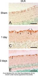 Anti-DLK/MAP3K12 antibody used in IHC (Frozen sections) (IHC-Fr). GTX124127