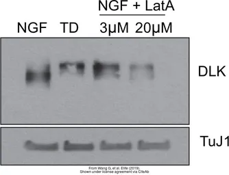 Anti-DLK/MAP3K12 antibody used in Western Blot (WB). GTX124127