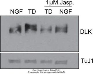 Anti-DLK/MAP3K12 antibody used in Western Blot (WB). GTX124127
