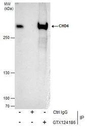 Anti-CHD4 antibody used in Immunoprecipitation (IP). GTX124186