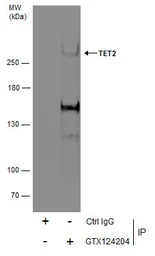 Anti-TET2 antibody [N2], N-term used in Immunoprecipitation (IP). GTX124204