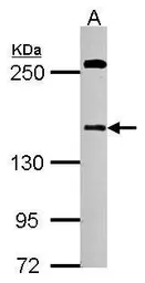 Anti-DZIP3 antibody [C1C2-2], Internal used in Western Blot (WB). GTX124219