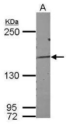 Anti-DZIP3 antibody used in Western Blot (WB). GTX124220
