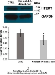 Anti-TERT antibody [C2C3-2], C-term used in Western Blot (WB). GTX124242