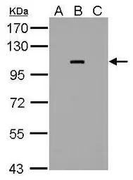 Anti-Dengue virus NS5 protein antibody used in Western Blot (WB). GTX124253