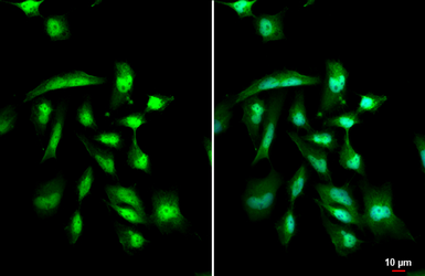 Anti-Gli1 antibody used in Immunocytochemistry/ Immunofluorescence (ICC/IF). GTX124274