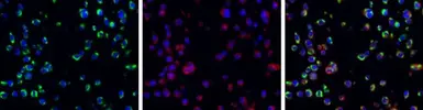 Anti-Dengue virus NS1 protein antibody used in IHC (Paraffin sections) (IHC-P). GTX124280