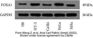 Anti-Gapdh antibody used in Western Blot (WB). GTX124502