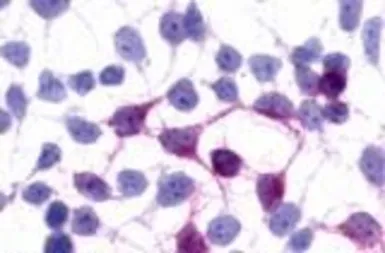 Anti-GPR45 antibody used in Immunocytochemistry/ Immunofluorescence (ICC/IF). GTX12574