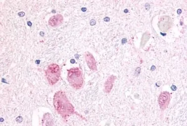 Anti-GPR45 antibody used in IHC (Paraffin sections) (IHC-P). GTX12574