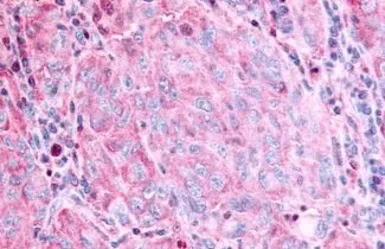 Anti-GPR45 antibody used in IHC (Paraffin sections) (IHC-P). GTX12574