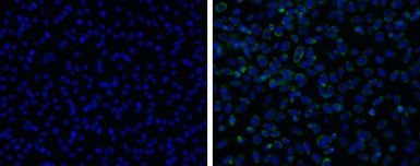 Anti-Japanese encephalitis virus Envelope antibody used in Immunocytochemistry/ Immunofluorescence (ICC/IF). GTX125867