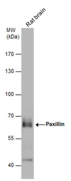 Anti-Paxillin antibody used in Western Blot (WB). GTX125891
