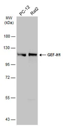 Anti-GEF-H1 antibody used in Western Blot (WB). GTX125893
