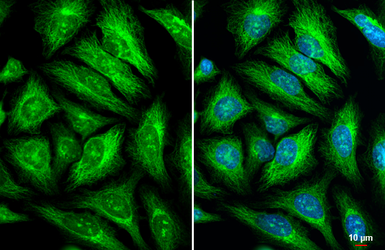 Anti-GEF-H1 antibody used in Immunocytochemistry/ Immunofluorescence (ICC/IF). GTX125893