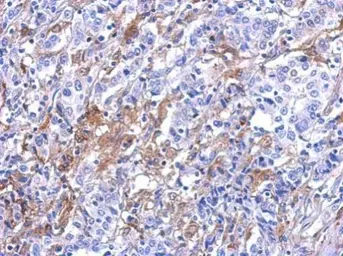 Anti-Galectin 3 antibody used in IHC (Paraffin sections) (IHC-P). GTX125897