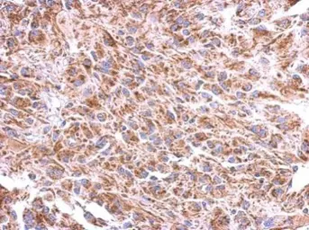 Anti-ST8SIA4 antibody used in IHC (Paraffin sections) (IHC-P). GTX125904