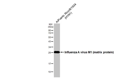 Anti-Influenza A virus M1 (matrix protein) antibody used in Western Blot (WB). GTX125928