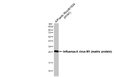 Anti-Influenza A virus M1 (matrix protein) antibody used in Western Blot (WB). GTX125928