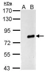 Anti-Influenza A virus PA protein antibody used in Western Blot (WB). GTX125933
