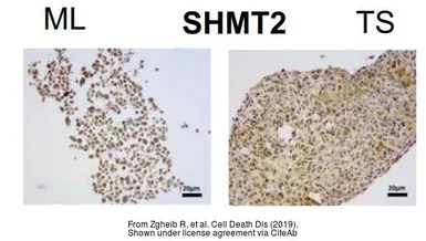 Anti-SHMT2 antibody used in IHC (Paraffin sections) (IHC-P). GTX125939