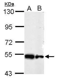 Anti-SHMT2 antibody used in Western Blot (WB). GTX125939