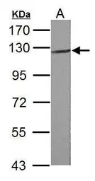 Anti-Cdh2 antibody used in Western Blot (WB). GTX125962