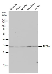 Anti-ARD1A antibody used in Western Blot (WB). GTX125971