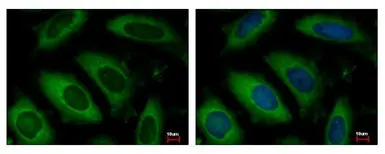 Anti-ARD1A antibody used in Immunocytochemistry/ Immunofluorescence (ICC/IF). GTX125971