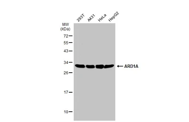 Anti-ARD1A antibody used in Western Blot (WB). GTX125971