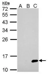 Anti-Japanese encephalitis virus NS2B antibody used in Western Blot (WB). GTX125972