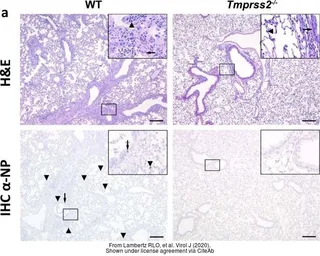 Anti-Influenza A virus Nucleoprotein antibody used in IHC (Paraffin sections) (IHC-P). GTX125989