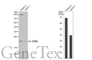 Anti-GPX8 antibody used in Western Blot (WB). GTX125992